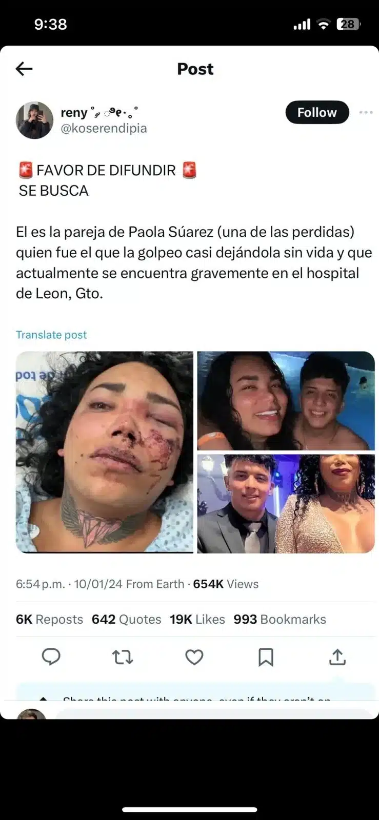 Paola Suárez podría perder el ojo tras brutal golpiza de su prometido; revela detalles de su grave estado de salud