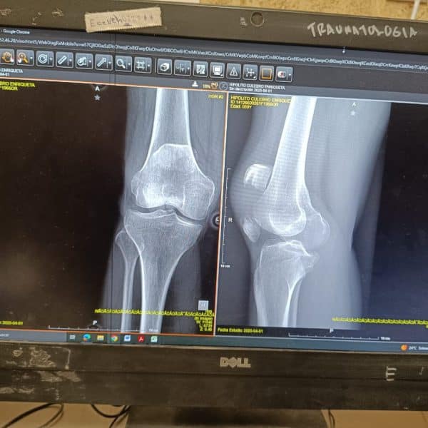 Mujer sufre fractura por coladera mal colocada tras&hellip;