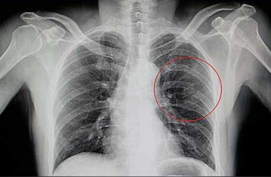 Feria del horror: policía somete, amarra…