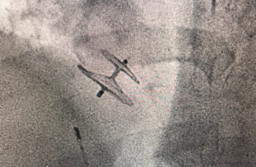 🚨🫀 ISSSTE en Querétaro salva a&hellip;