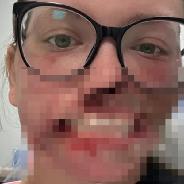 🔴🐕 Perro ataca a su dueña mientras sufría&hellip;