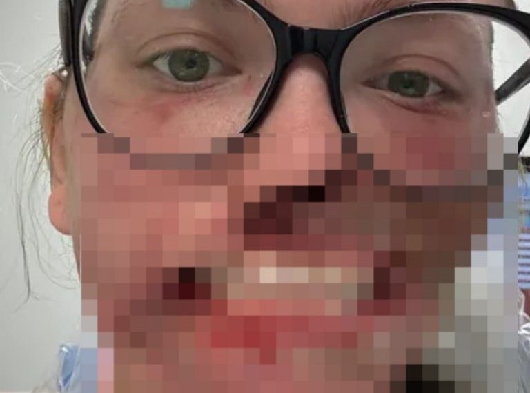 🔴🐕 Perro ataca a su dueña&hellip;