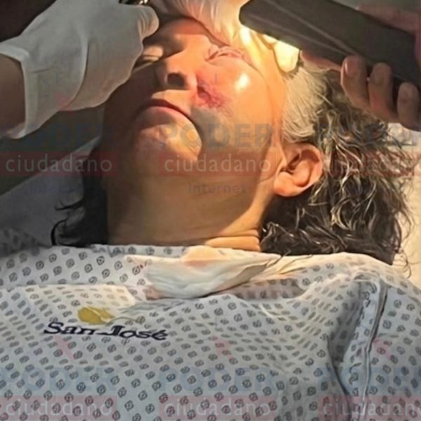 💔🚨 Maestra de 62 años perdió la vista&hellip;